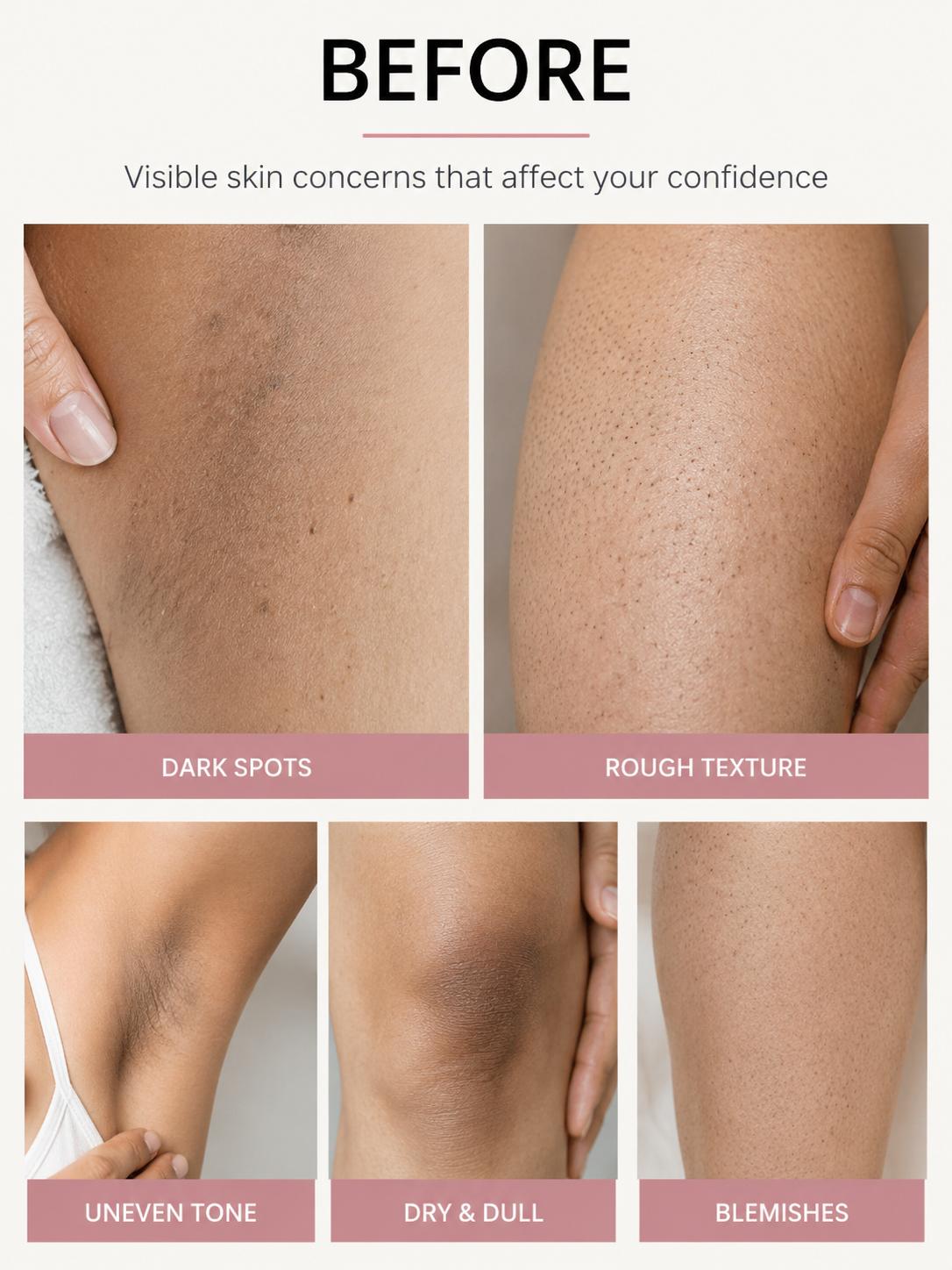 Peel Shot™ 3-in-1 Exfoliating Body Spray