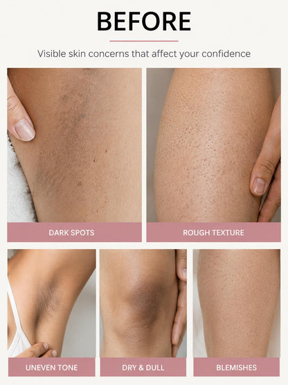 Peel Shot™ 3-in-1 Exfoliating Body Spray